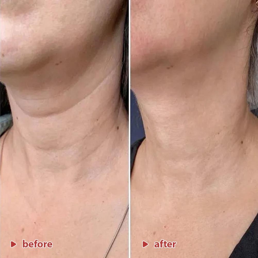 Crema para el Cuello Coreana K - Peptide Neck Cream reseña y precio