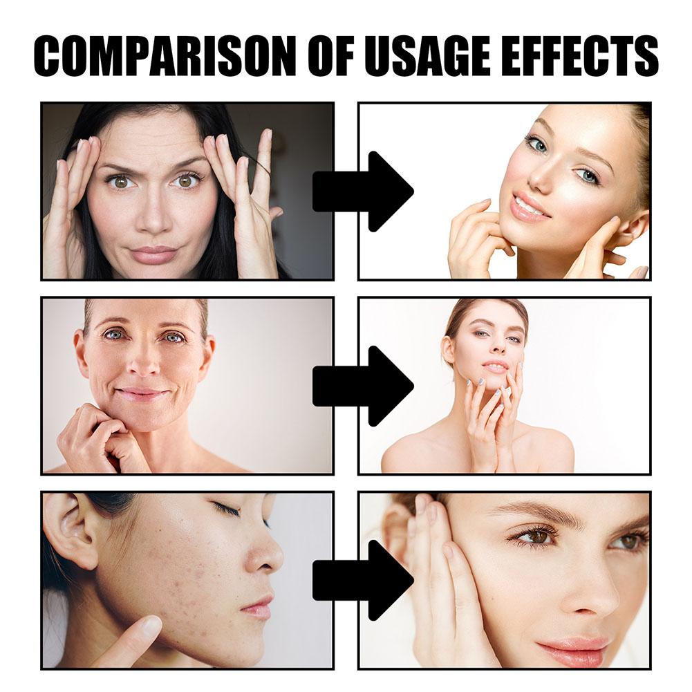 Crema de sangre de dragón para - Skincare Retinol reseña y precio