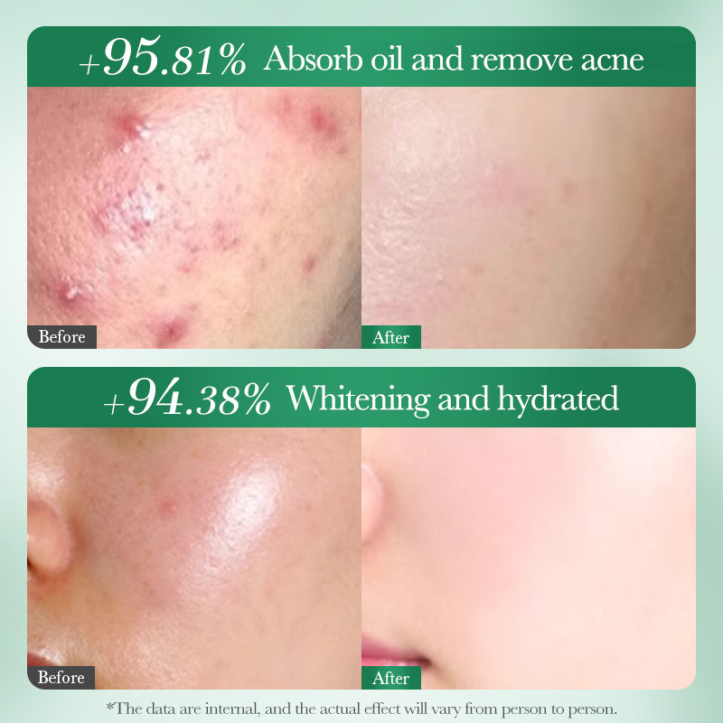 Limpiador Facial blanqueador y - Salicylic Acid Cleanser reseña y precio