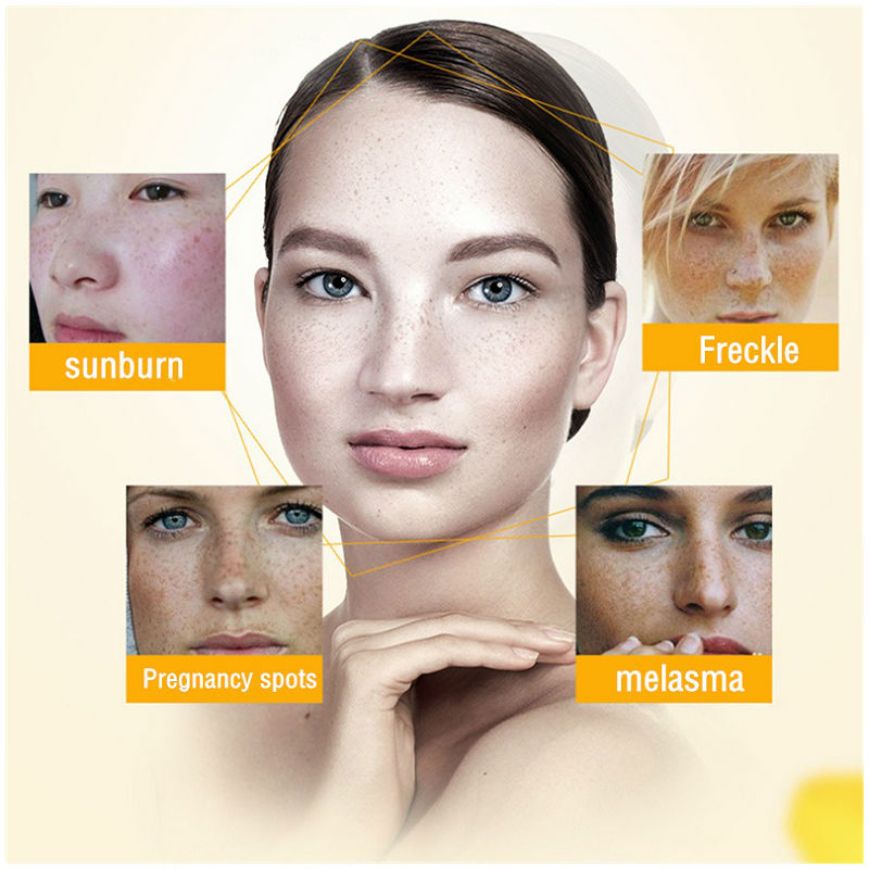 Dimollaure-crema blanqueadora  - Skincare Retinol reseña y precio
