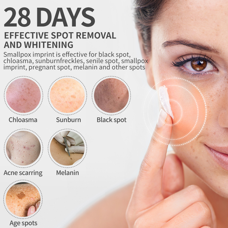 Dimollaure-crema blanqueadora  - Skincare Retinol reseña y precio
