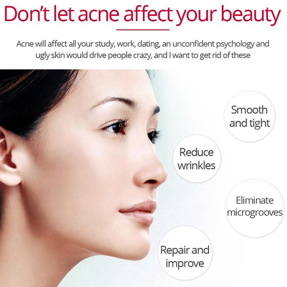 Crema reafirmante Lifting de R - Skincare Retinol reseña y precio